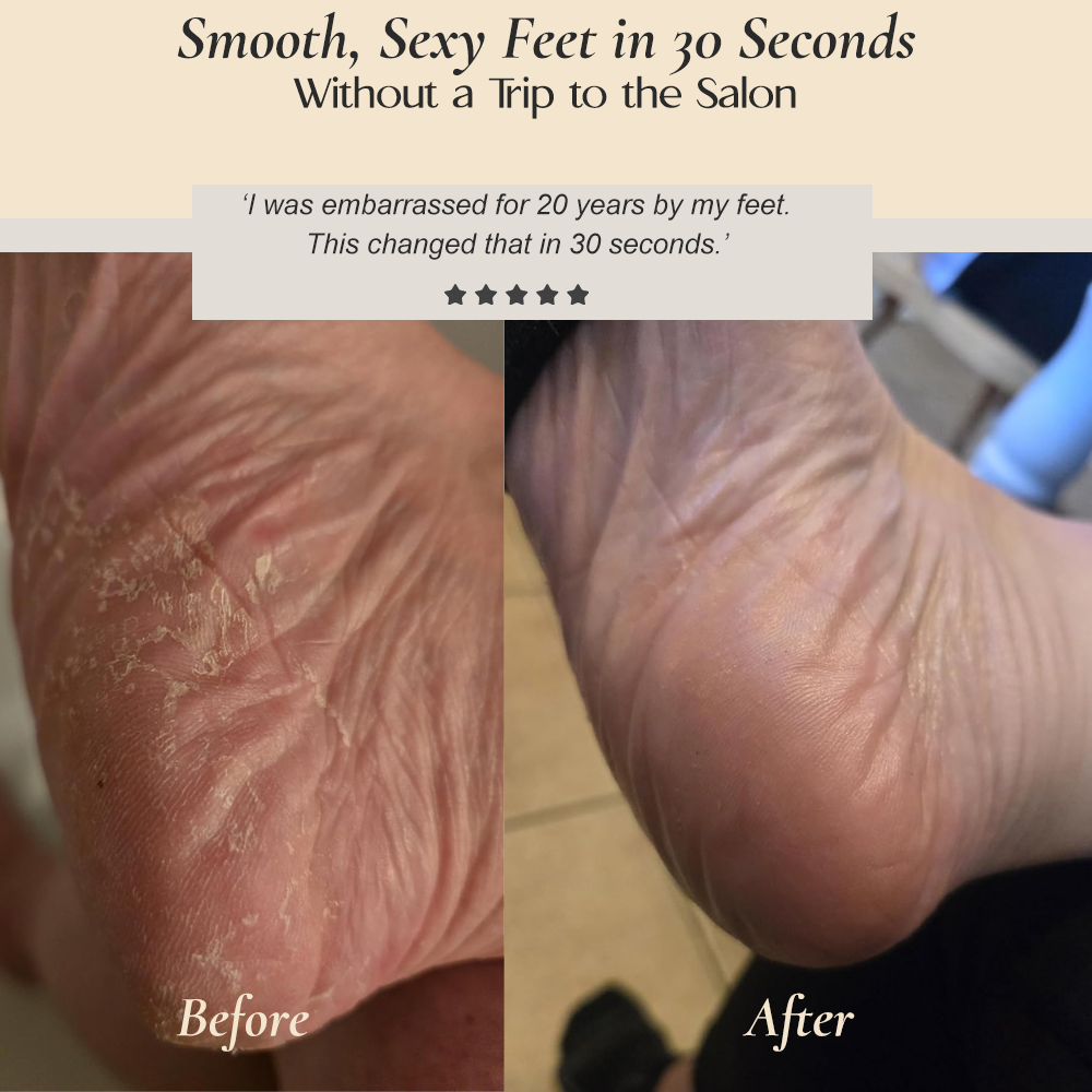 LOOSIA Soft Heel Reset Ritual™