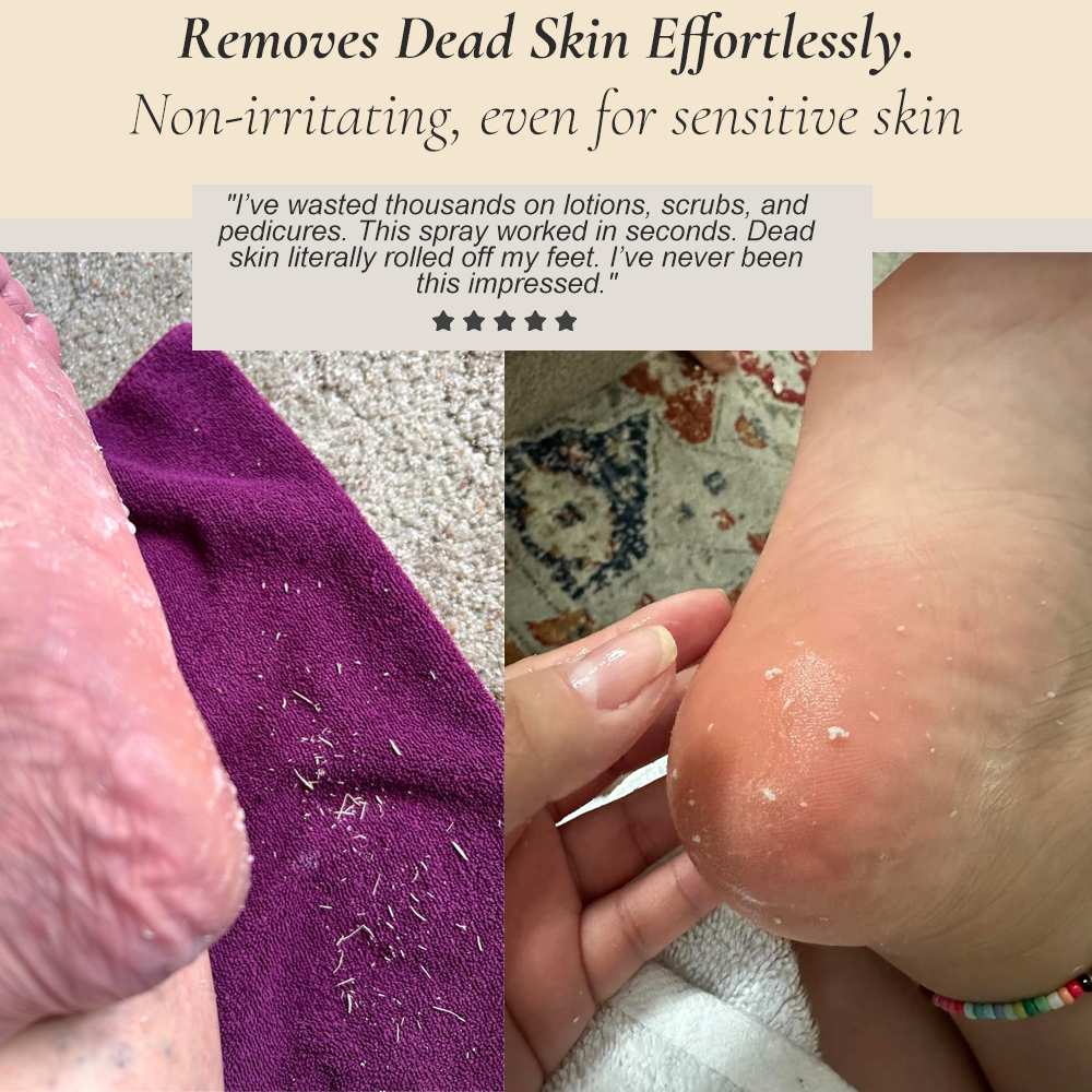LOOSIA Soft Heel Reset Ritual™