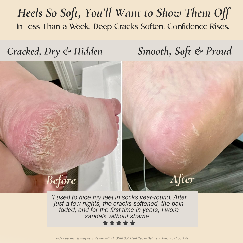 LOOSIA Soft Heel Reset Ritual™